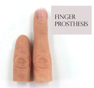 Finger Prosthesis